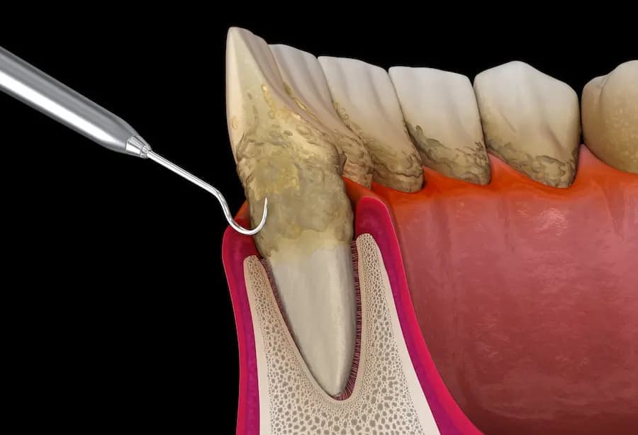 Periodontics & Oral Surgery
