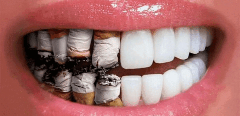 3-on-6 Dental Implants
