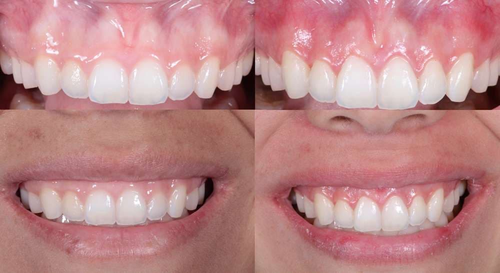 What to do about bad breath